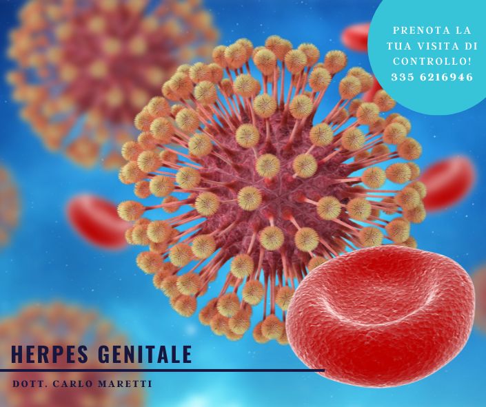 herpes genitale