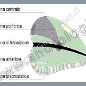 Rappresentazione schematica delle varie zone della ghiandola prostatica.