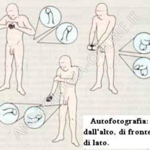 autofoto che va sempre proposta al paziente al fine di documentare la presenza e l’entità dell’incurvamento. Queste tre posizioni sono le più idonee per ottenere una fotografia in erezione che permetta la valutazione obiettiva dell’entità dell’incurvament