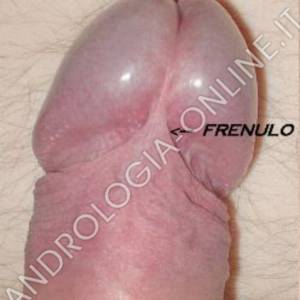 Frenulo del pene