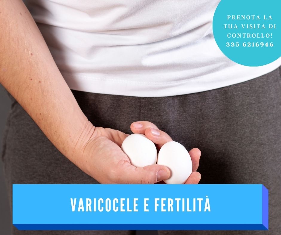 varicocele 2025